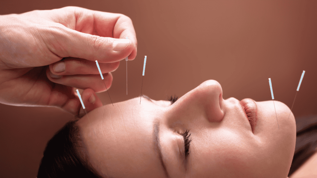 Best Website Design for Acupuncture